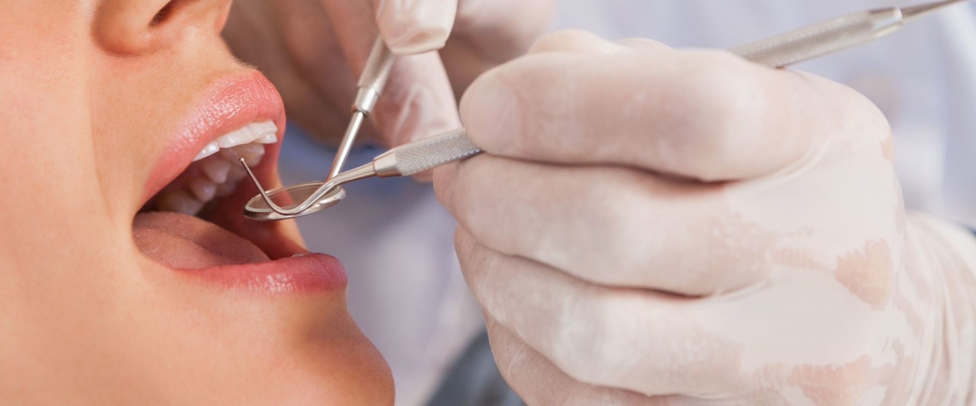 What Materials Can UK Dentists Use for Fillings and Crowns?