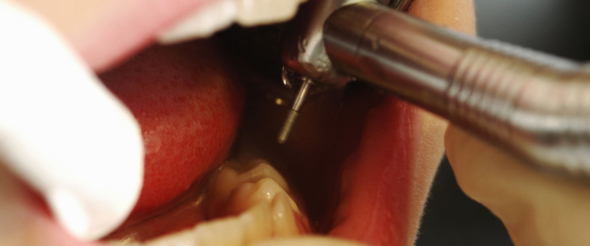 Can a Dentist Refuse Treatment in the UK?