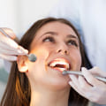 What Treatments Can Private Dentists in the UK Provide?