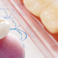 How Much Does it Cost to Get a Crown Fitted at a UK Dentist?
