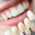 Do Britons Have Better Teeth Than Americans?