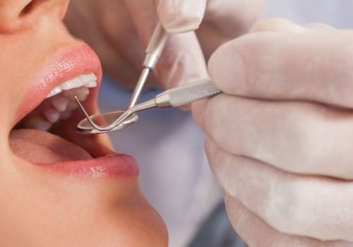 What Materials Can UK Dentists Use for Fillings and Crowns?