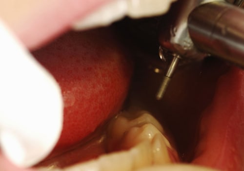Can a Dentist Refuse Treatment in the UK?