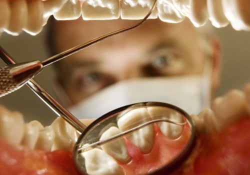 How Often Should You Have Your Teeth Checked by a UK Dentist for Signs of Decay or Gum Disease?
