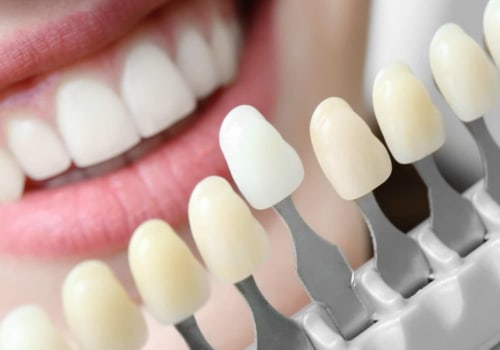 Do Britons Have Better Teeth Than Americans?